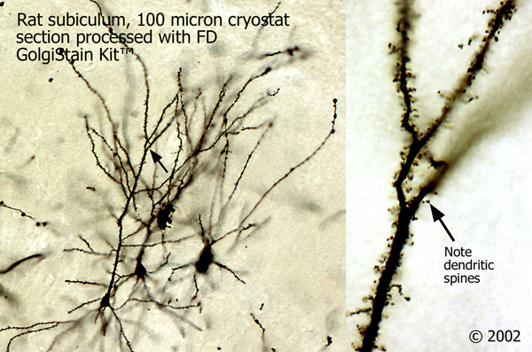 【COLOR iN ID】tassle golgi long ops Rapid Golgi Stain Kit for Fast Neuronal Analysis - FD Neuro